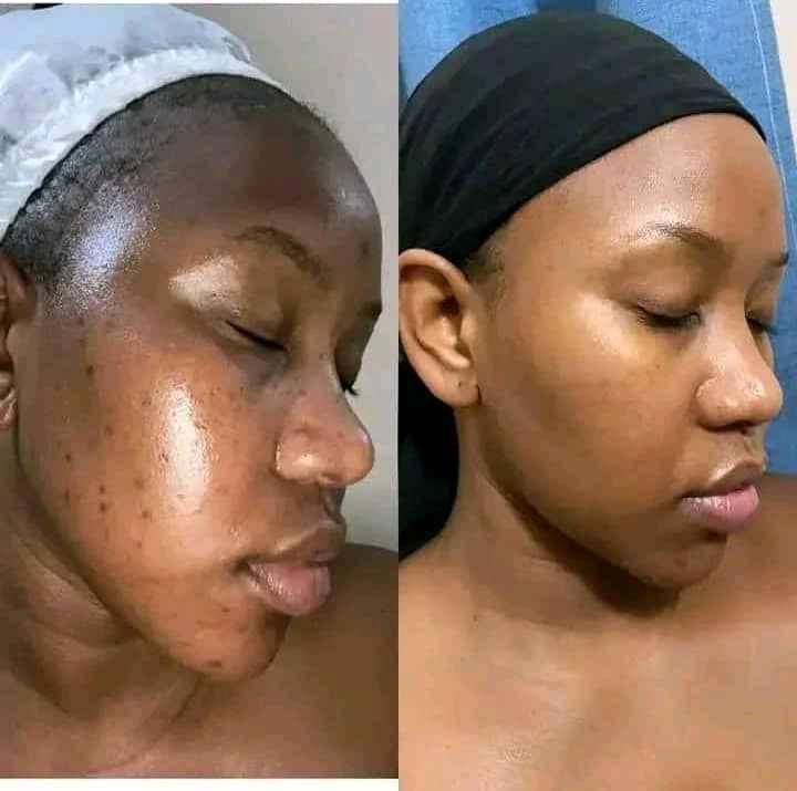 miira tiara ya skin problems ekola ndwade za nsusu 14 fine for sale in Kampala - Yilick