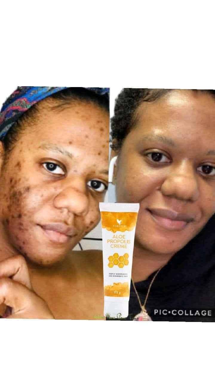 aloe propolis creme for sale in Kampala - Yilick